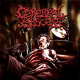 Cerebral Abscess – Cerebral Abscess